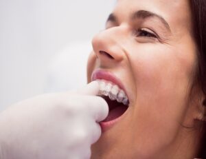 Am I a good candidate for Invisalign?